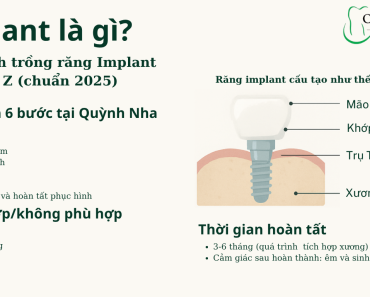 🦷 Implant Là Gì? Quy Trình Trồng Răng Implant Từ A–Z (Chuẩn 2025)